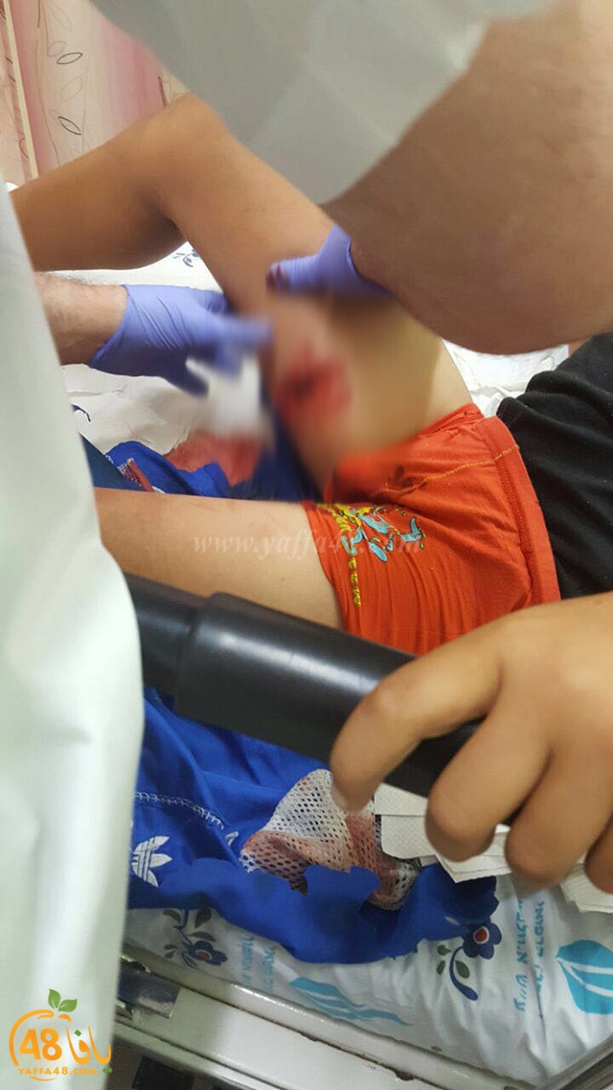 kid dog attack (2).jpg